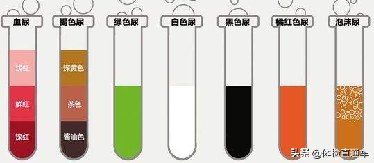 尿液中泡沫多是肾脏出了问题？夜尿增多又是为什么？
