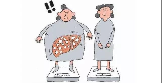 肥胖会引起肝疾病吗,肥胖导致肝损害