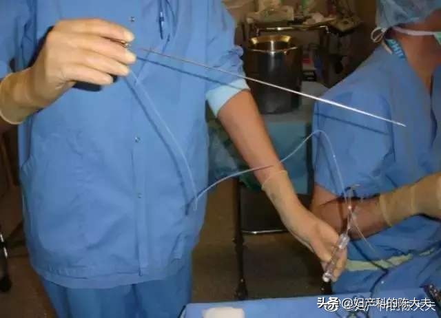 女性试管成功率多大,试管婴儿女性要遭受多大的罪