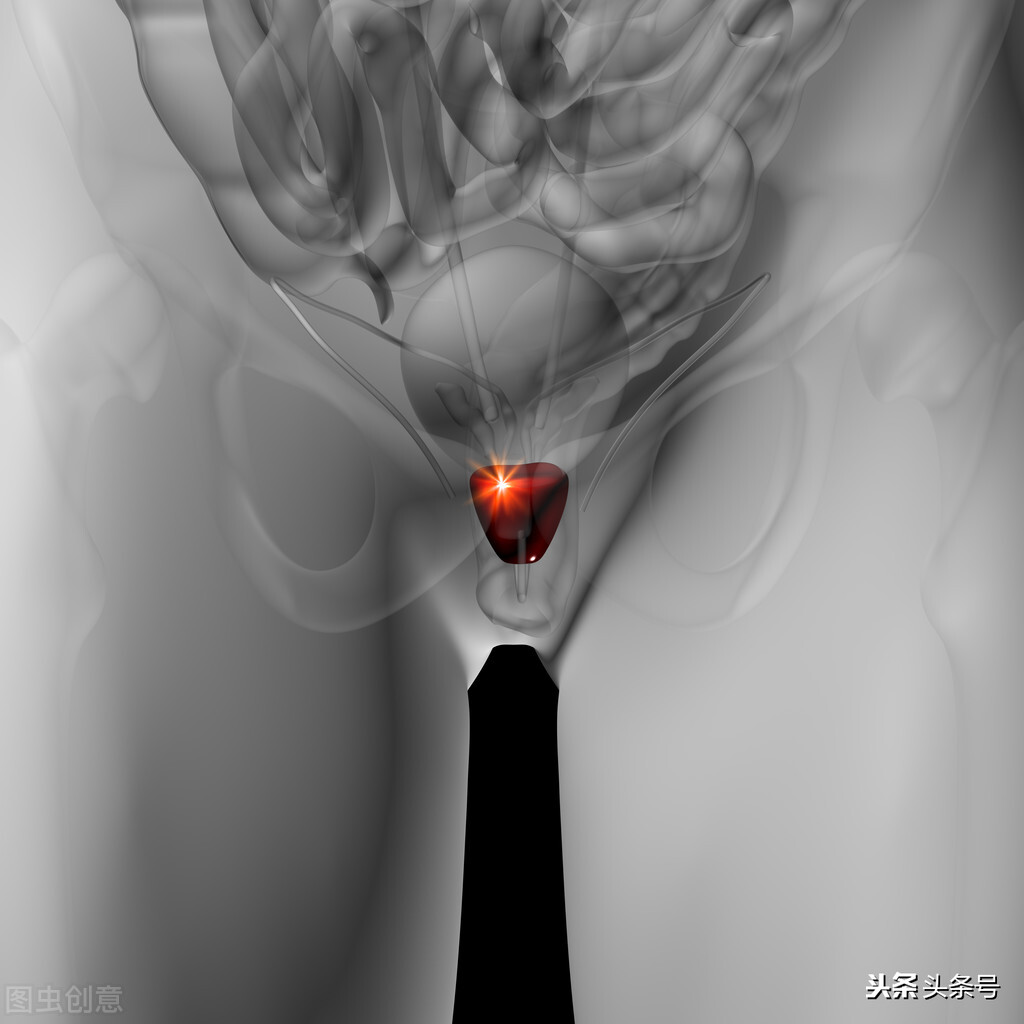 前列腺炎怎么治疗吃什么药知乎,前列腺炎怎么治疗和早泄有关系吗