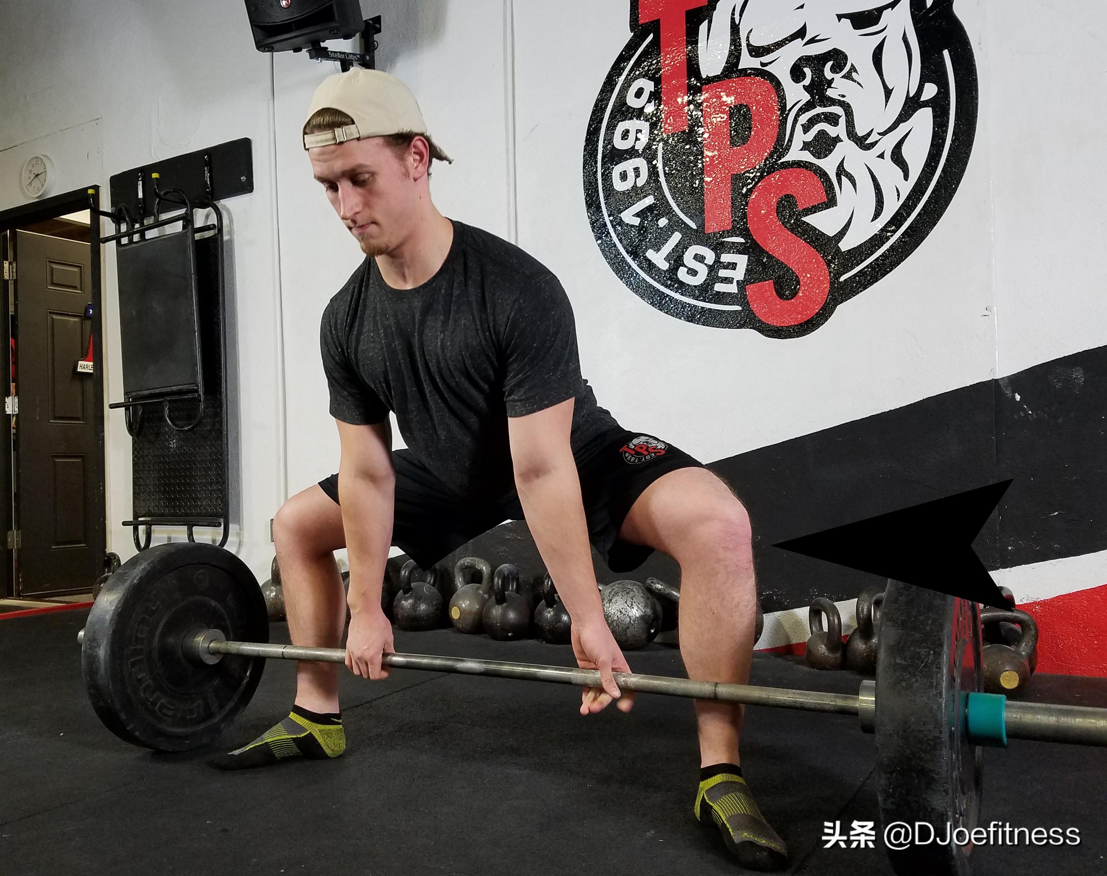 腰部损伤能好吗,腰受伤了以后还能做硬拉吗