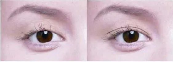 最漂亮的双眼皮形态,双眼皮形态分类