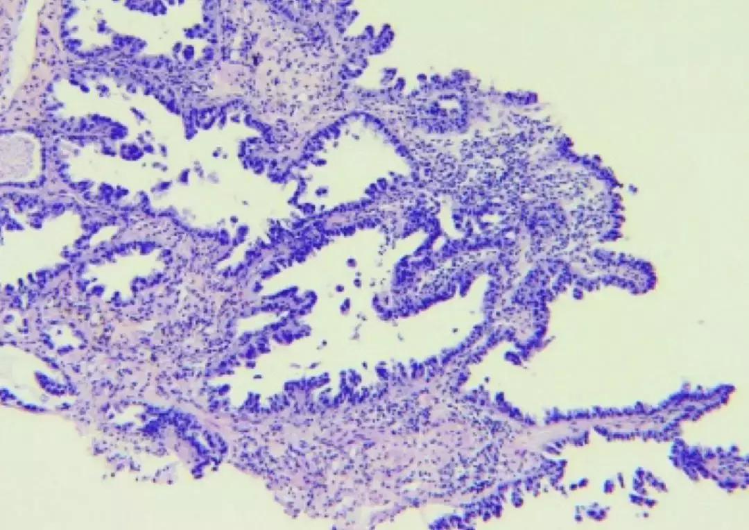 抗菌药物不合理处方分析,抗菌药物用药不合理的表现
