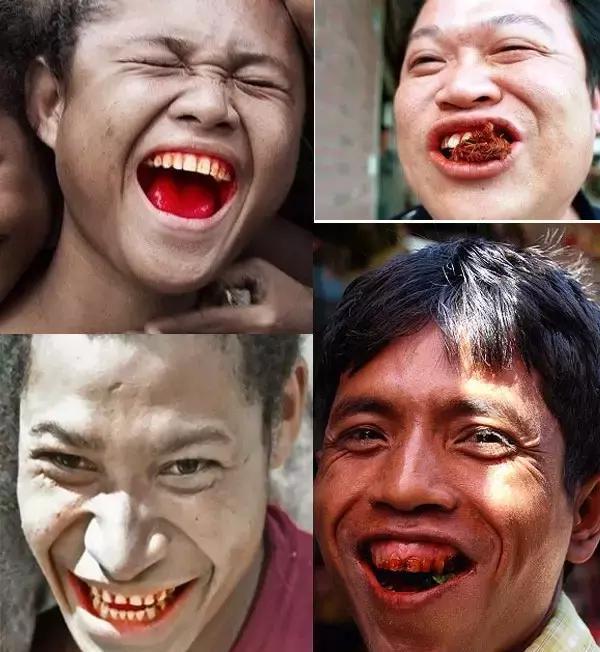 槟榔为什么会让人患口腔癌,嚼槟榔真的会导致口腔癌吗