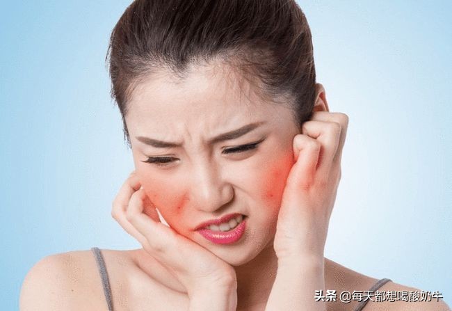 如何改善脸上皮肤特别薄，一直泛红，毛孔粗大，*血丝红**明显？