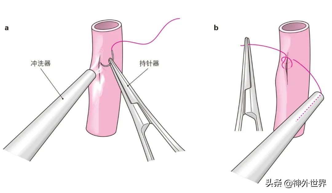 日本治神经损伤特效药,脑动脉炎症状与治疗