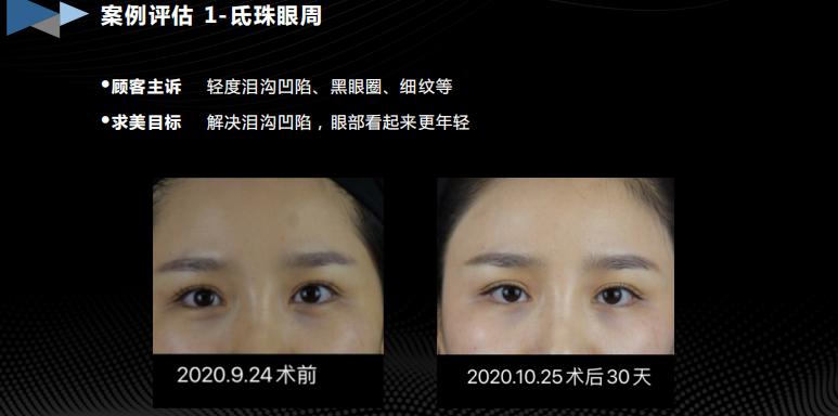 胶生灌养眼周抗衰是什么产品?