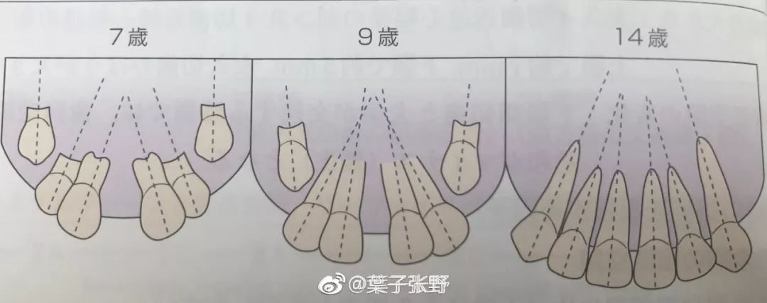 4岁小孩儿牙缝大正常吗,小朋友牙缝大正常吗