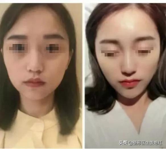 变美逆袭逆龄抗衰变美小妙招,逆龄抗衰手法一起开启变美之路