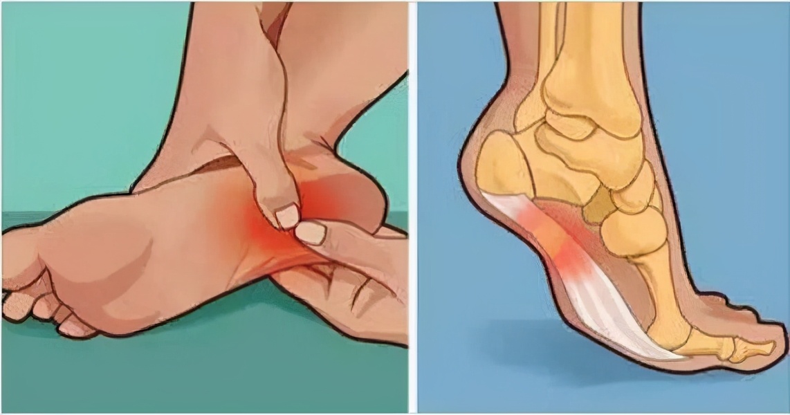 怎么证明没脚气,没有药如何处理脚气