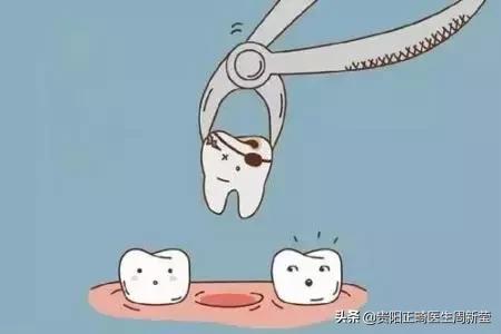 拔牙有什么好方法吗,拔牙有什么好办法不痛