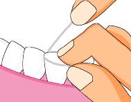 牙缝1cm太大医生说补不了,牙缝上面细下面大能补吗