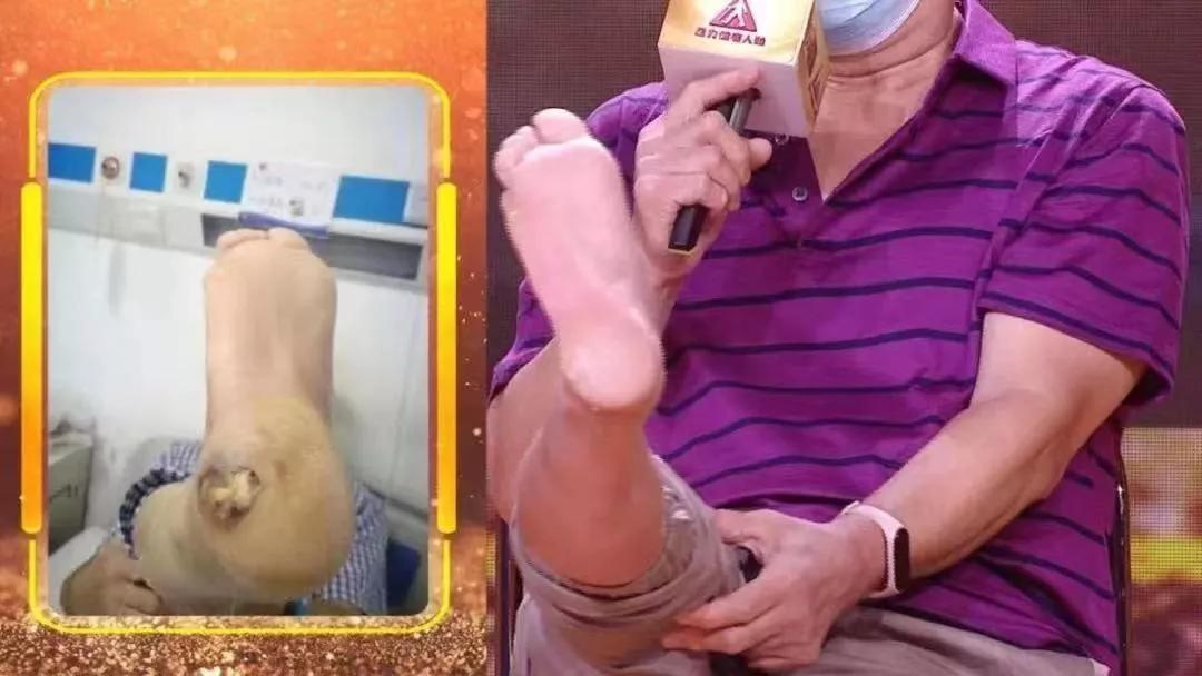 如何提高抗寒冷抵抗力,女性比男性更抗冻吗