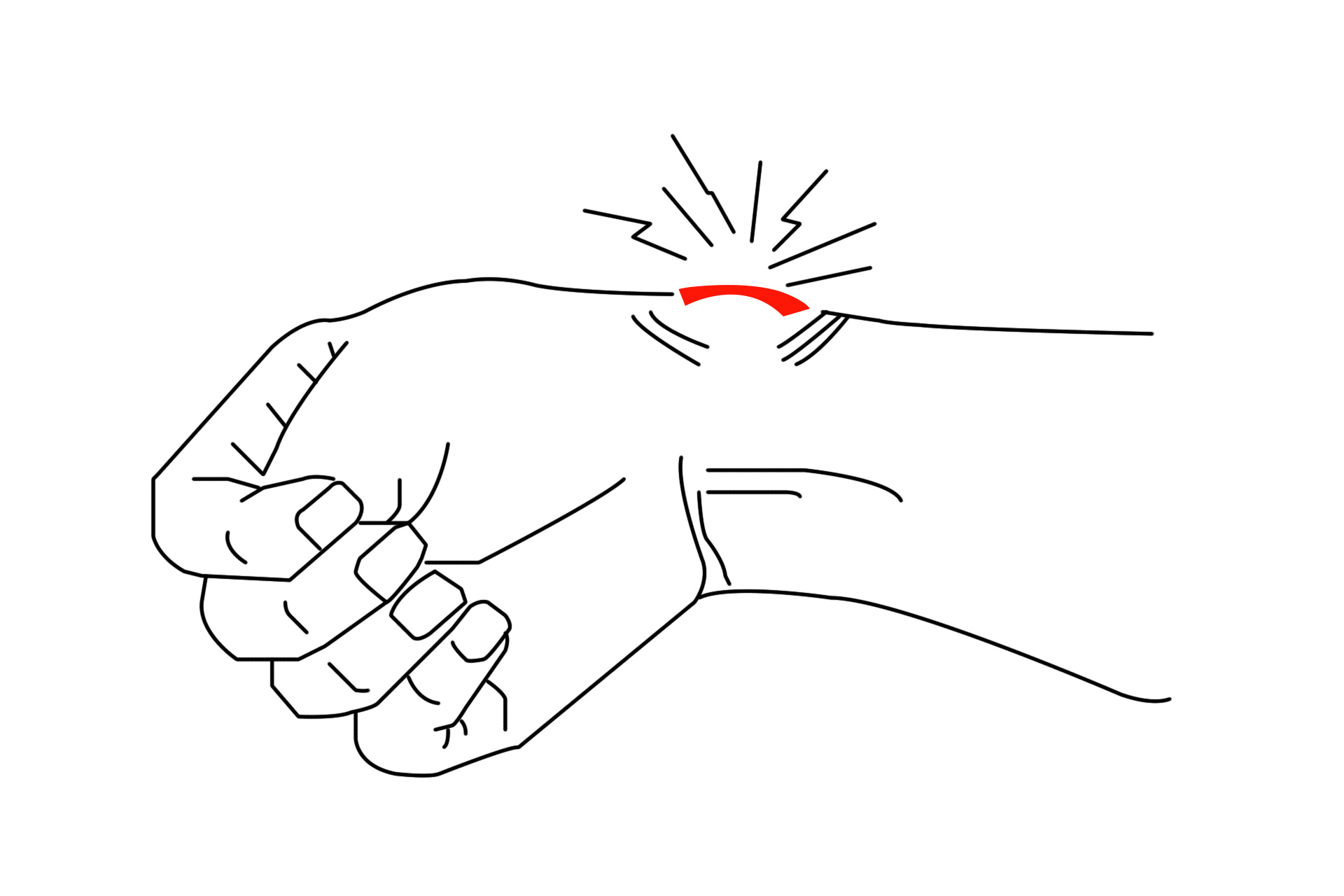 手腕疼痛无法弯曲怎么治疗,手腕腱鞘炎手使不上劲