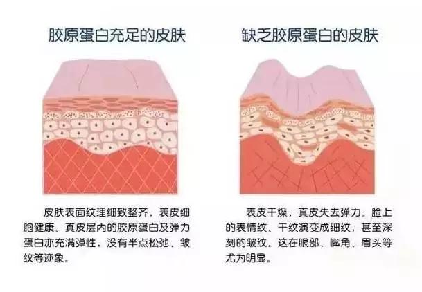 皮肤松弛下垂一招解决,一招解决皮肤松弛下垂