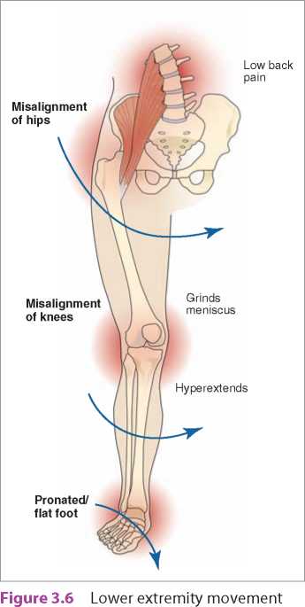 治疗扁平足,聊聊足弓塌陷