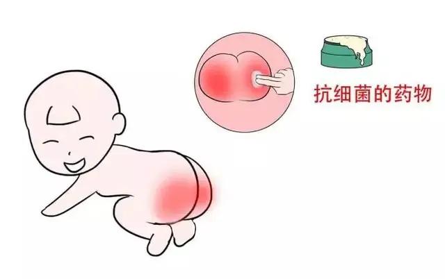 宝宝红屁股了该怎么护理好,宝宝红屁股了怎样护理能快速好