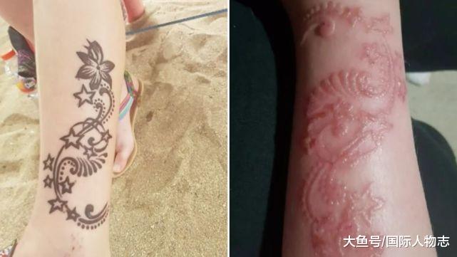 海娜纹身有害吗,海娜纹身有危害吗