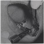 多图直击！牙医如何用抛光把孩子的牙洗干净？#葉子口腔科普#