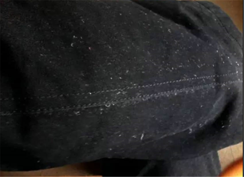 为什么洗衣机洗完衣服有油渍,洗衣机洗的衣服好多白毛怎么办