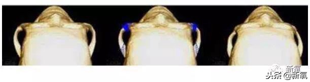 辛芷蕾是苦相女生吗,辛芷蕾气质怎么养成