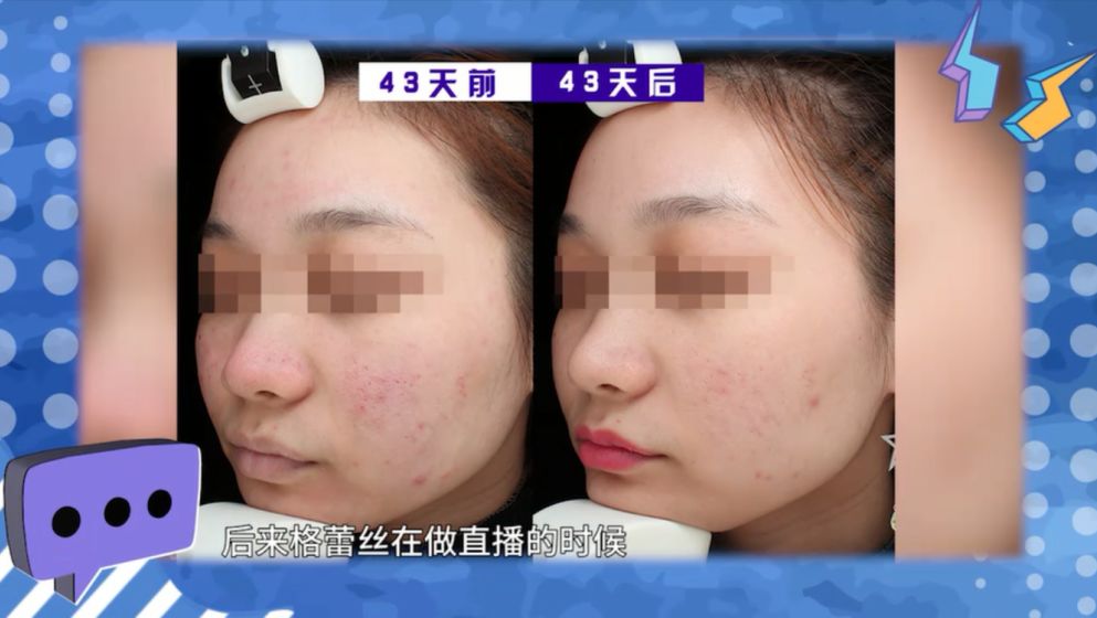 30分钟去黄提亮，变身白美人！皮肤学博士为它强力打call