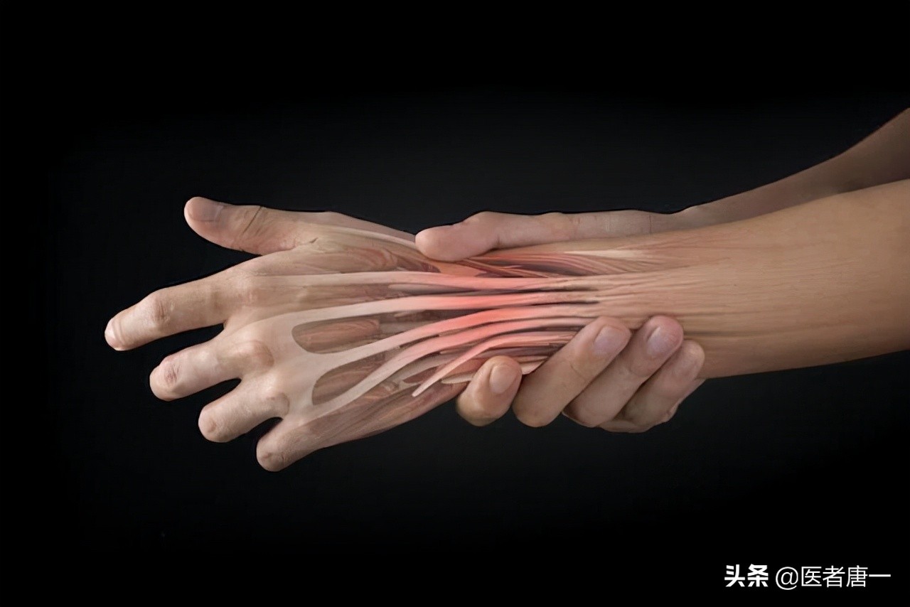 50多岁女性手指腱鞘炎怎么治,59岁女性容易发腱鞘炎应注意什么