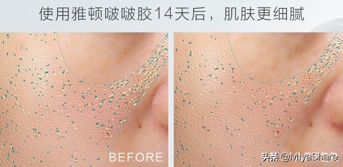 雅顿啵啵胶适合什么皮肤,雅顿啵啵胶适合年龄