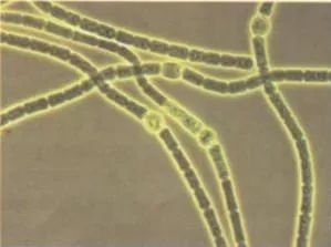 藻类用什么药消灭最好,藻类最佳治疗方法视频