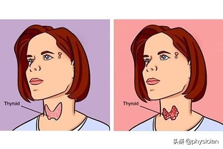 治疗拉肚子蒙脱石散与哪些药合用,肚子咕噜咕噜响还拉肚子吃什么药