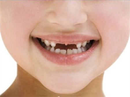 牙齿科普整牙堪比整形,整牙堪比换脸真的假的