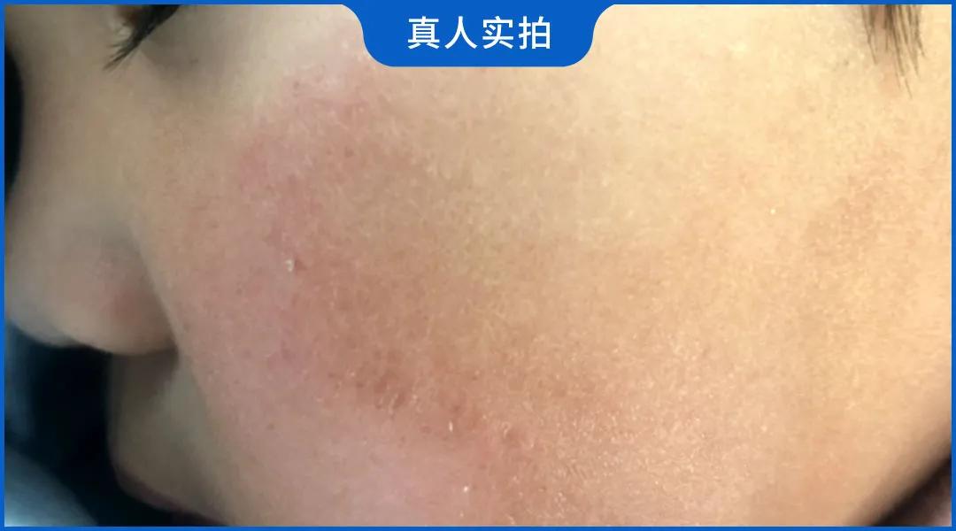 小孩冬天脸部干燥开裂面霜测评,儿童面霜推荐干皮保湿