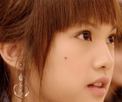 皮肤长了个黑痣褐色会是癌症吗,黑痣附近痒疼是癌症症状表现吗