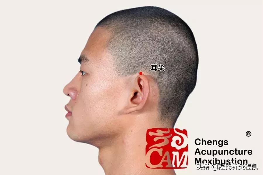 多囊肾线上咨询,多囊肾问诊