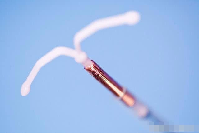 备孕二胎取节育环在什么时间最好,取节育环后多久可以怀孕最佳