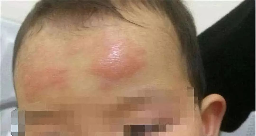 退热贴育儿,小儿退热贴骗局