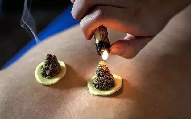 顺产坐月子抱娃腰疼怎么治,产后缓解腰痛能要小孩吗