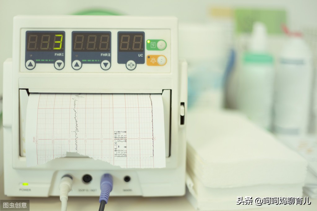 孕晚期胎监不过需要做什么检查,孕晚期胎监不好医生要催生