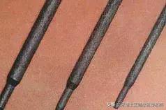 纤维桩修复费用,纤维桩修复全过程视频