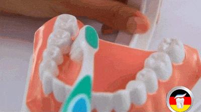 牙齿上抠出来的泥垢很臭怎么办,牙齿上能抠出白色的泥怎么解决