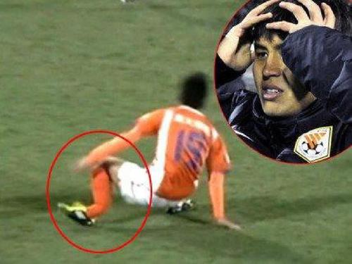 胫腓骨骨折需要注意什么,胫腓骨骨折有哪些类型