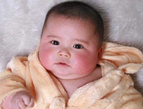 13岁男孩湿疹一年反反复复,1岁多孩子湿疹是什么原因