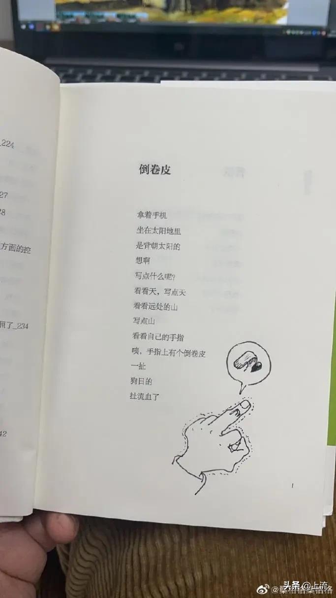 为什么总是忍不住拔倒刺,为什么会忍不住撕倒刺