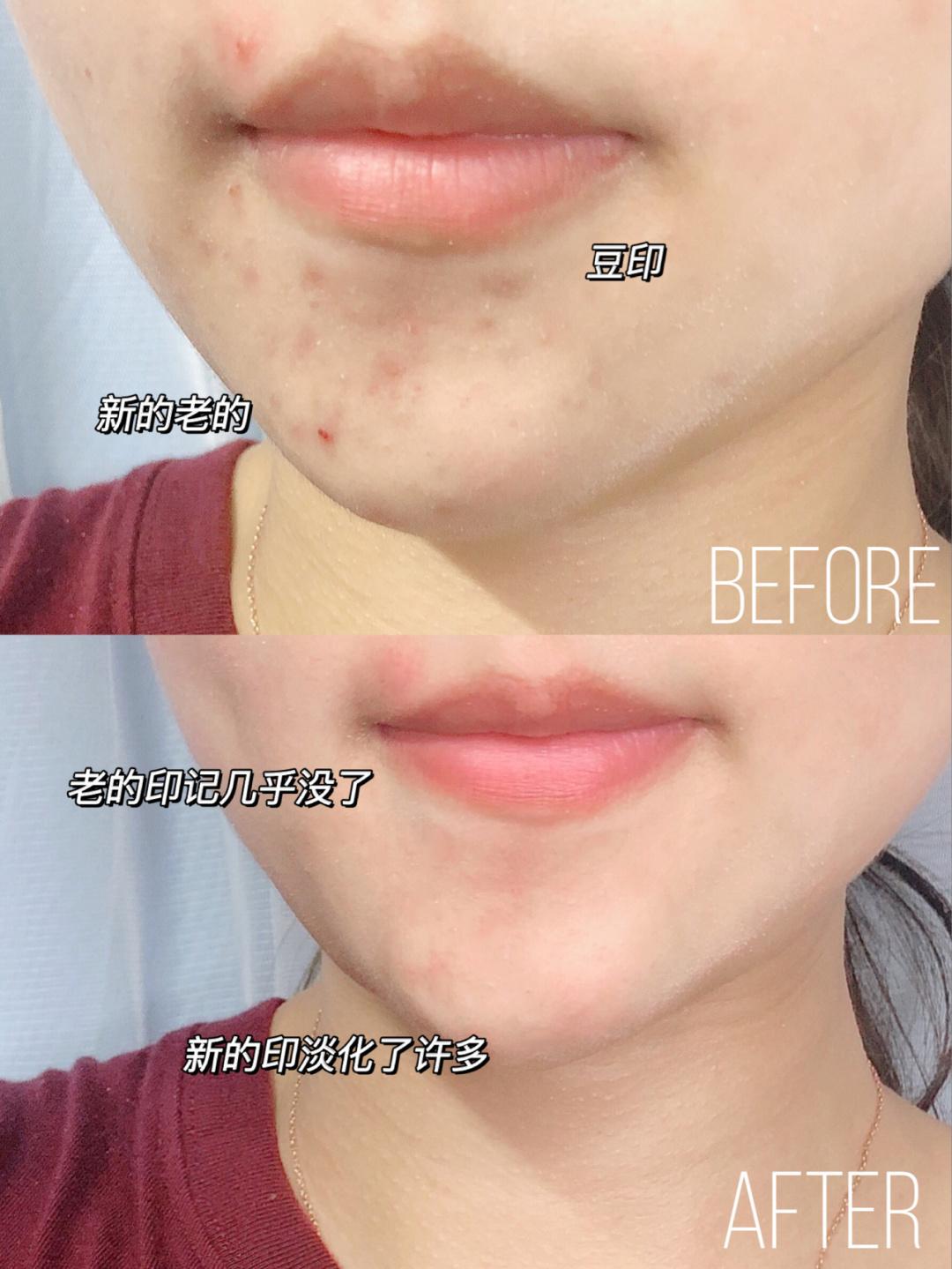 良心好用国货化妆品,超市有哪些值得买的护肤品