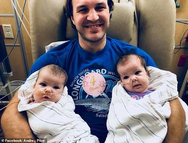 这对要上牛津剑桥的姐妹花,16年前是连体婴!存活率仅百万分之一