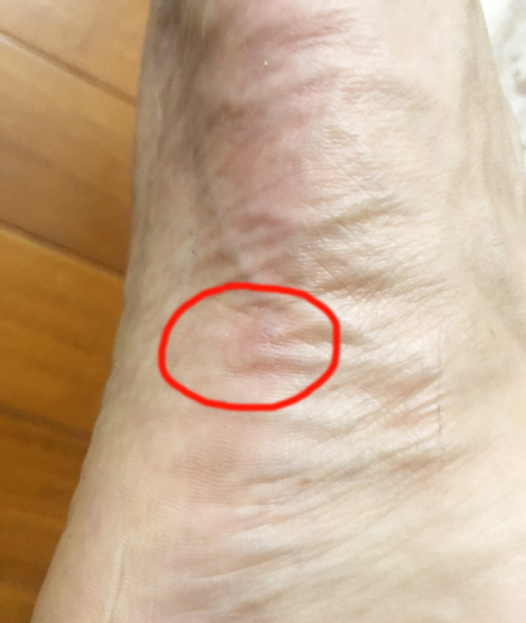 剖开中底寻真相，AJ33卡脚原因大揭秘