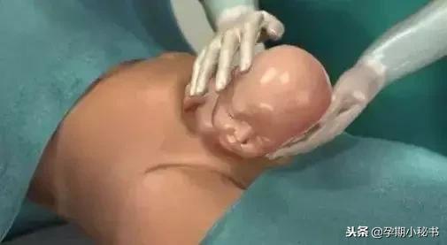 顺产生孩子剖腹产的真实流程,顺产剖腹产生孩子的真实流程
