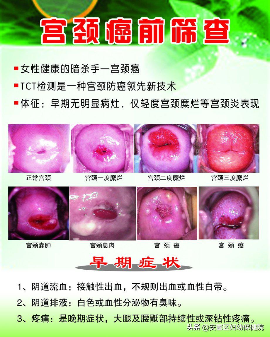 关爱女性健康远离hpv,关爱女性健康hpv成功转阴