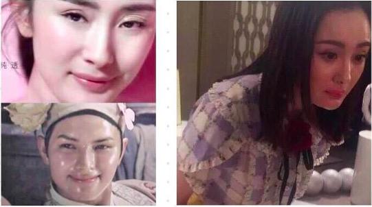 杨幂这些整容后遗症告诉你，不断返厂重修，代价得不偿失