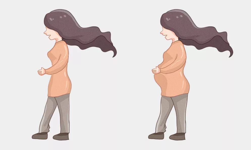 怀孕期间出现妊娠纹该怎么办,怀孕妊娠纹怎样消除